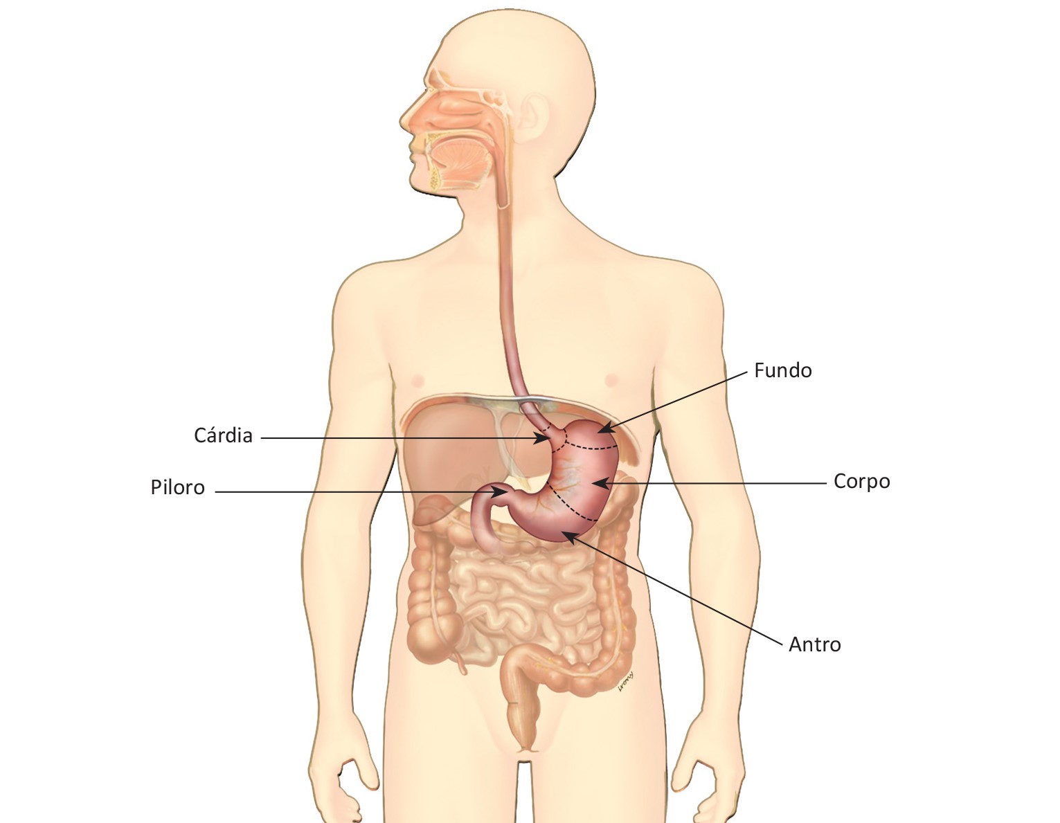 Cancer gastrico peritoneal. Chimioterapia hipertermică (HIPEC) | Anadolu Medical Center